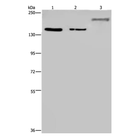 KDM3B Antibody from Signalway Antibody (36562) - Antibodies.com