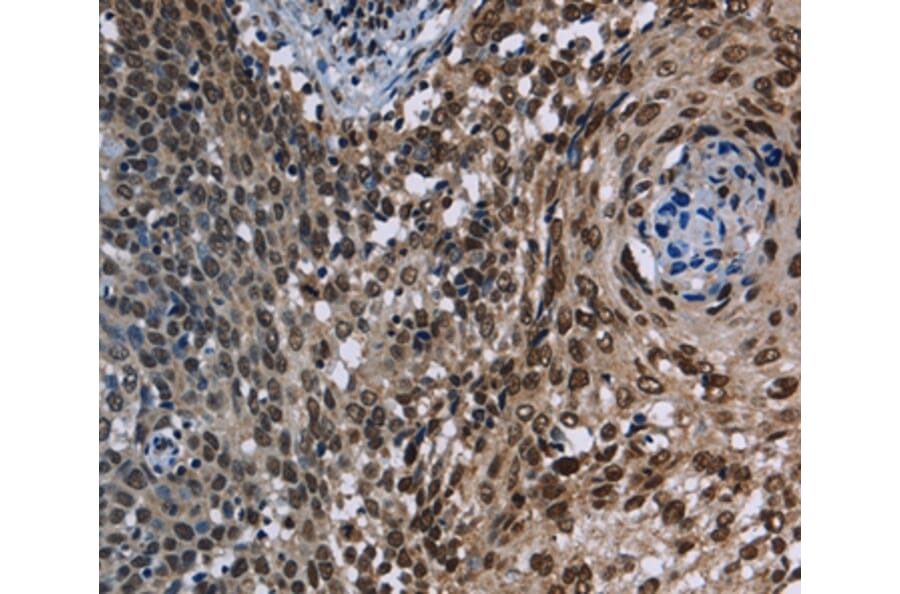 Immunohistochemistry - KDM3B Antibody from Signalway Antibody (36562) - Antibodies.com