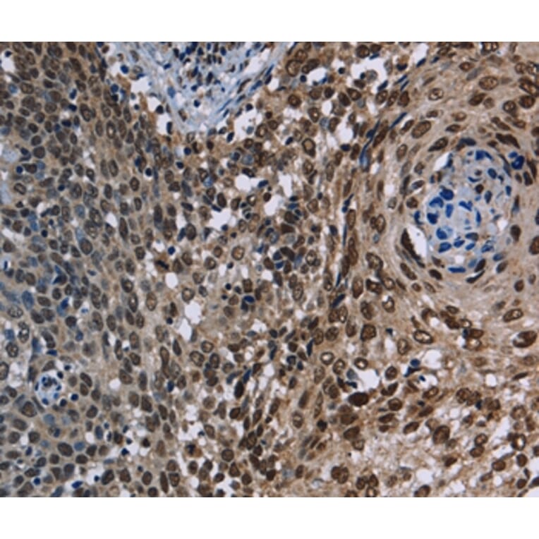 Immunohistochemistry - KDM3B Antibody from Signalway Antibody (36562) - Antibodies.com