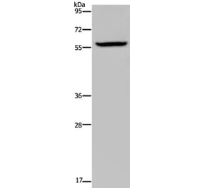KDM4D Antibody from Signalway Antibody (36563) - Antibodies.com