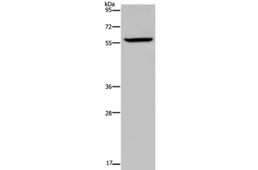 KDM4D Antibody from Signalway Antibody (36563) - Antibodies.com