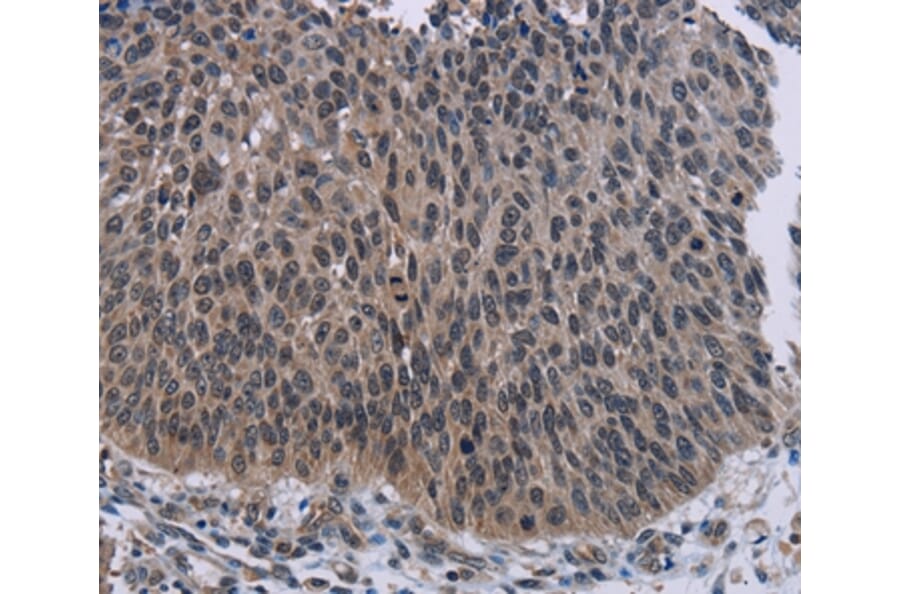 Immunohistochemistry - KDM4D Antibody from Signalway Antibody (36563) - Antibodies.com