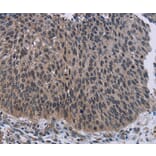 Immunohistochemistry - KDM4D Antibody from Signalway Antibody (36563) - Antibodies.com