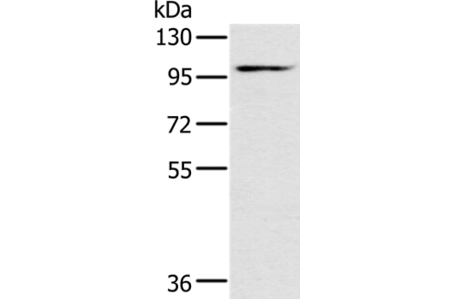 KCNQ5 Antibody from Signalway Antibody (36568) - Antibodies.com