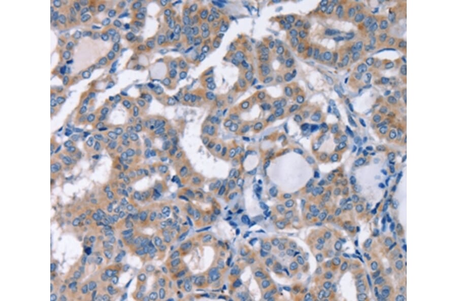 Immunohistochemistry - KCNQ5 Antibody from Signalway Antibody (36568) - Antibodies.com