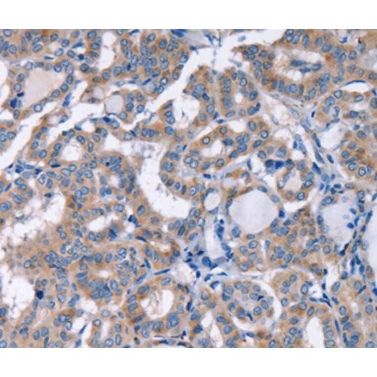 Immunohistochemistry - KCNQ5 Antibody from Signalway Antibody (36568) - Antibodies.com