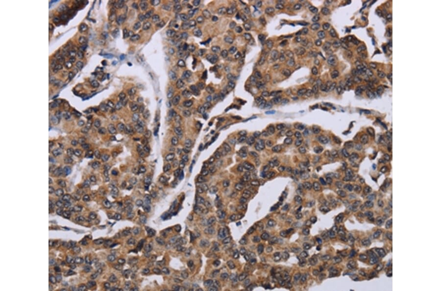 Immunohistochemistry - KIF1C Antibody from Signalway Antibody (36569) - Antibodies.com