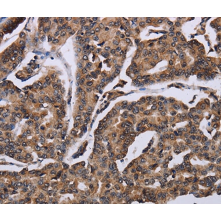 Immunohistochemistry - KIF1C Antibody from Signalway Antibody (36569) - Antibodies.com
