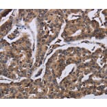 Immunohistochemistry - KIF1C Antibody from Signalway Antibody (36569) - Antibodies.com