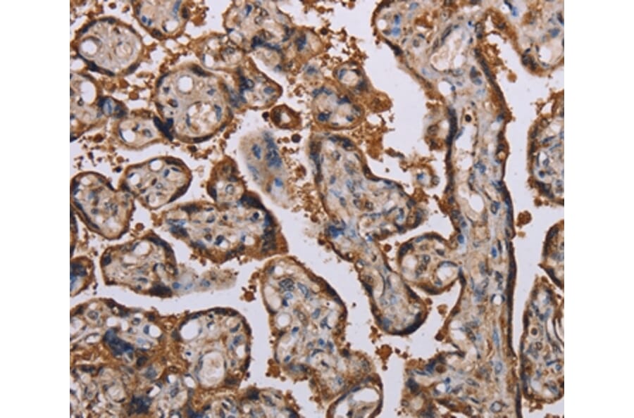 Immunohistochemistry - KIF2A Antibody from Signalway Antibody (36570) - Antibodies.com