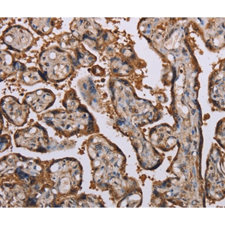 Immunohistochemistry - KIF2A Antibody from Signalway Antibody (36570) - Antibodies.com