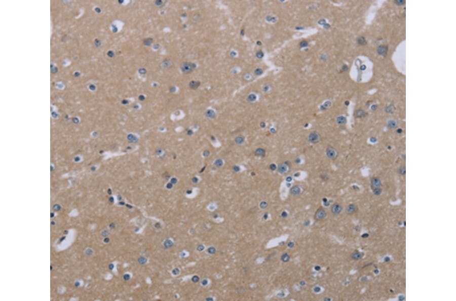 Immunohistochemistry - KLHL2 Antibody from Signalway Antibody (36573) - Antibodies.com