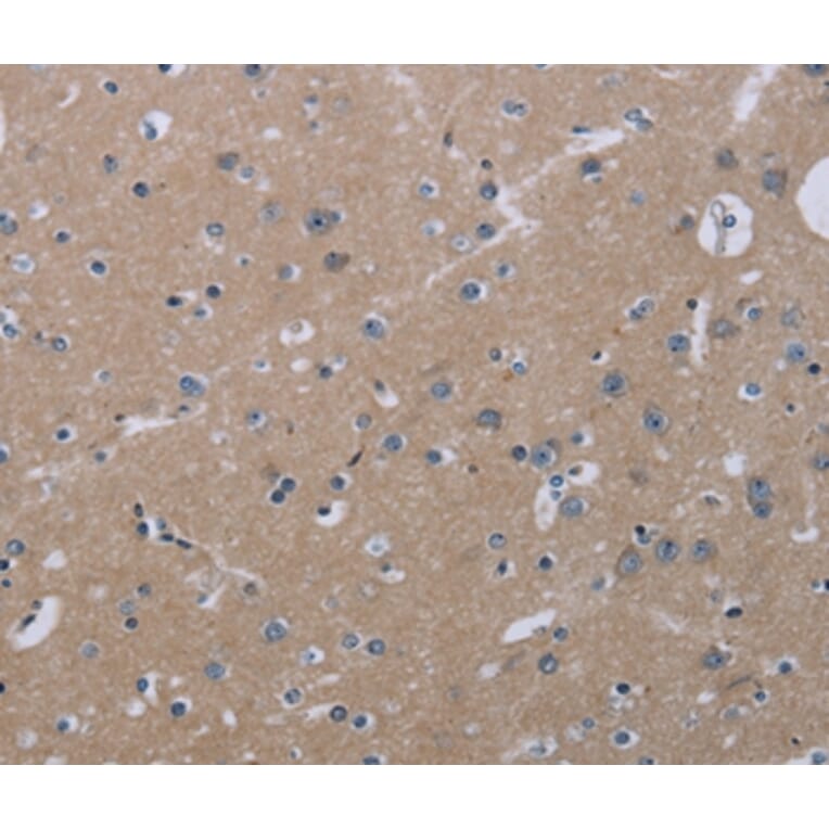 Immunohistochemistry - KLHL2 Antibody from Signalway Antibody (36573) - Antibodies.com