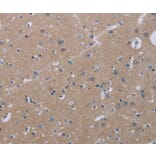 Immunohistochemistry - KLHL2 Antibody from Signalway Antibody (36573) - Antibodies.com