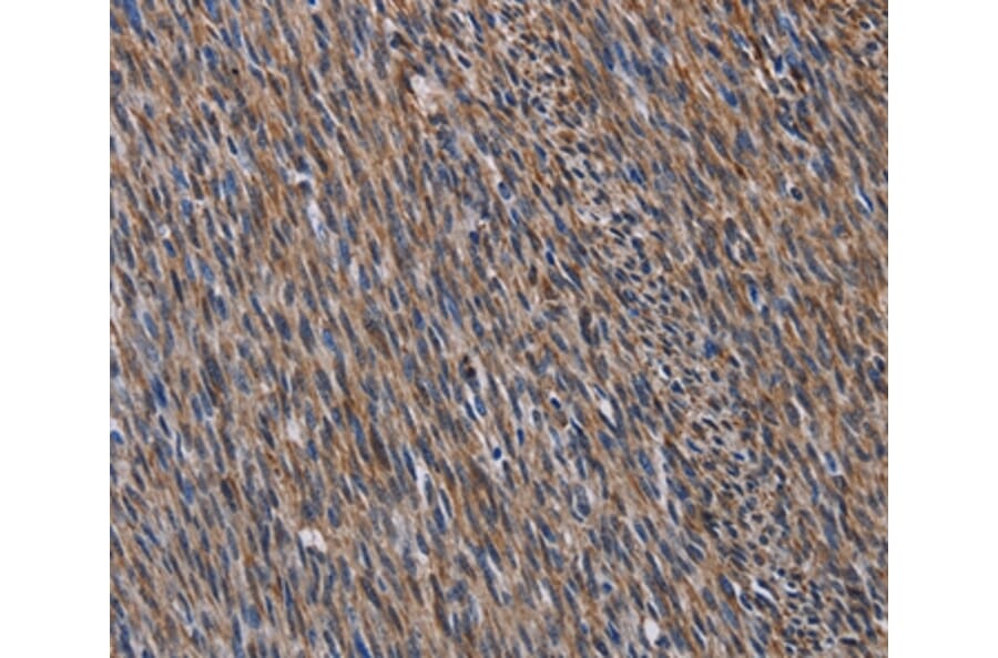Immunohistochemistry - LAMB3 Antibody from Signalway Antibody (36581) - Antibodies.com