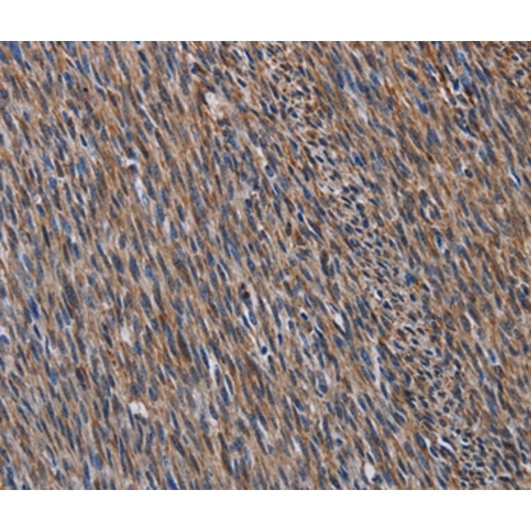 Immunohistochemistry - LAMB3 Antibody from Signalway Antibody (36581) - Antibodies.com