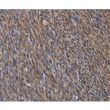 Immunohistochemistry - LAMB3 Antibody from Signalway Antibody (36581) - Antibodies.com