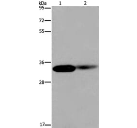 LIMS1 Antibody from Signalway Antibody (36586) - Antibodies.com