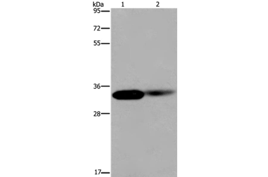 LIMS1 Antibody from Signalway Antibody (36586) - Antibodies.com