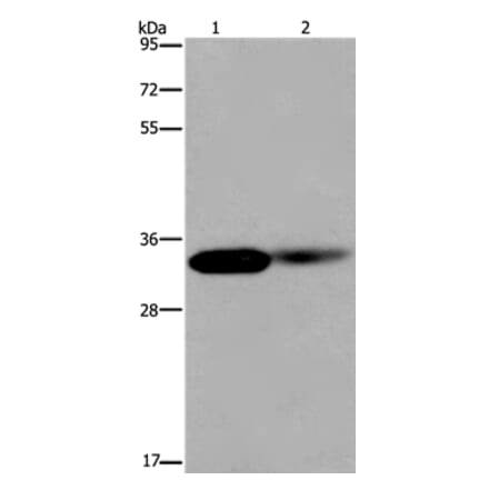 LIMS1 Antibody from Signalway Antibody (36586) - Antibodies.com