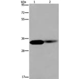 LIMS1 Antibody from Signalway Antibody (36586) - Antibodies.com