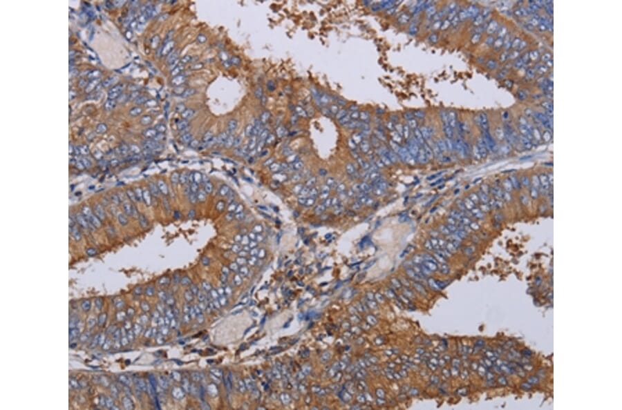 Immunohistochemistry - LIMS1 Antibody from Signalway Antibody (36586) - Antibodies.com