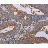 Immunohistochemistry - LIMS1 Antibody from Signalway Antibody (36586) - Antibodies.com