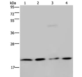 MCTS1 Antibody from Signalway Antibody (36605) - Antibodies.com