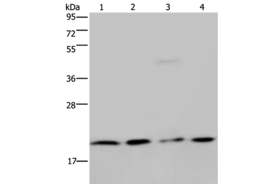 MCTS1 Antibody from Signalway Antibody (36605) - Antibodies.com
