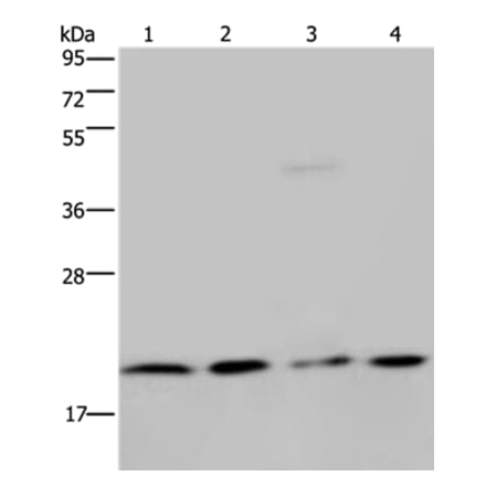 MCTS1 Antibody from Signalway Antibody (36605) - Antibodies.com