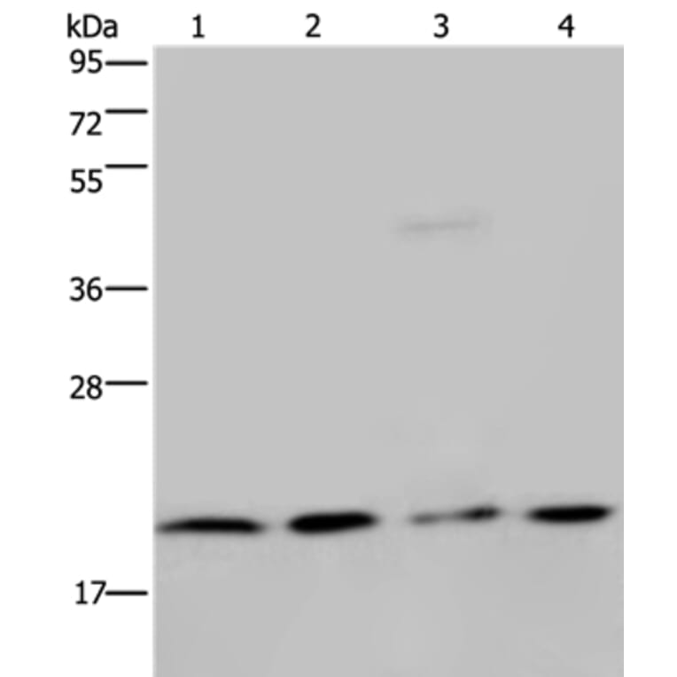 MCTS1 Antibody from Signalway Antibody (36605) - Antibodies.com