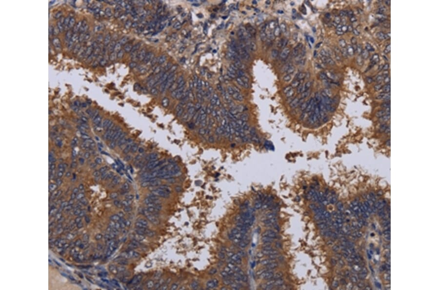 Immunohistochemistry - MCTS1 Antibody from Signalway Antibody (36605) - Antibodies.com
