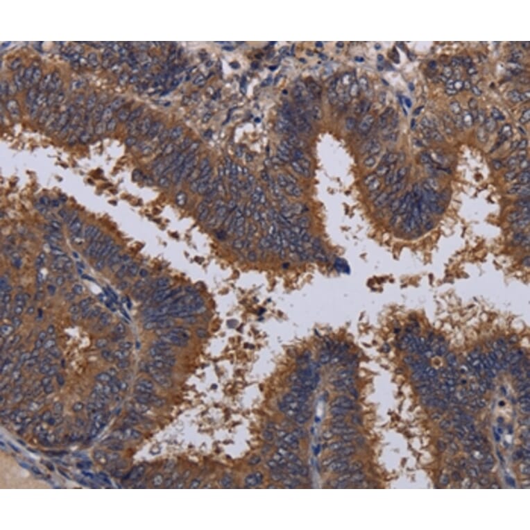 Immunohistochemistry - MCTS1 Antibody from Signalway Antibody (36605) - Antibodies.com