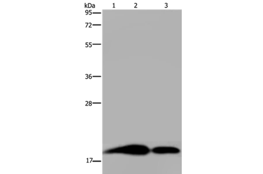 REG3G Antibody from Signalway Antibody (36614) - Antibodies.com