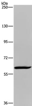 Gel: 6%SDS-PAGE Lysate: 40ug Hela cell Primary antibody: 1/550 dilution Secondary antibody dilution: 1/8000 Exposure time: 10 minutes