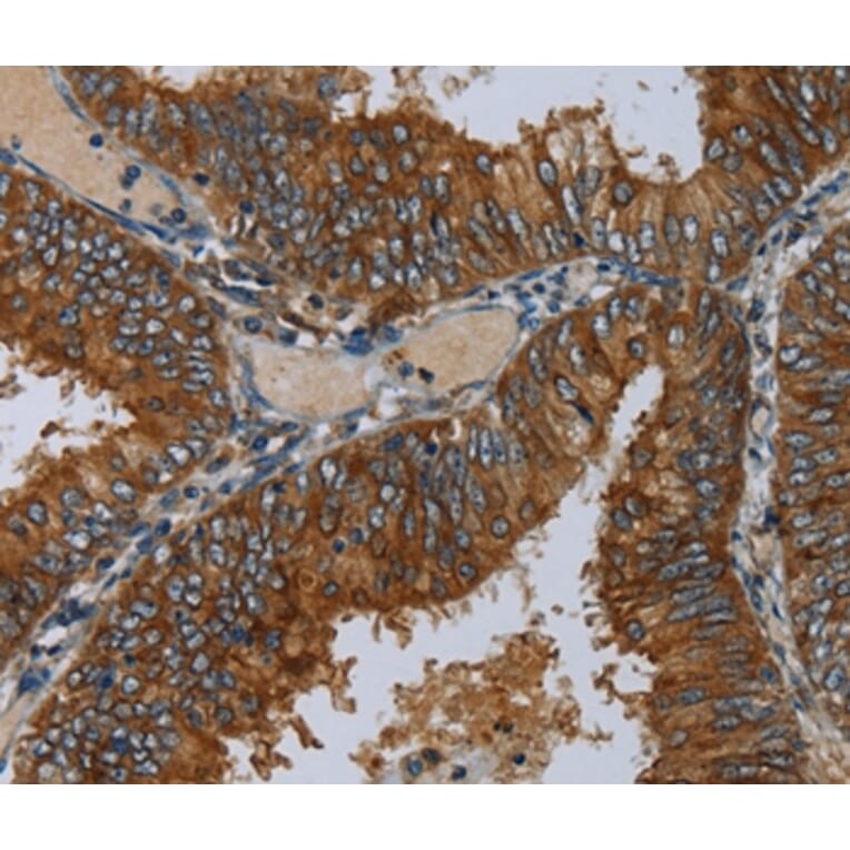 Immunohistochemistry - MIER2 Antibody from Signalway Antibody (36617) - Antibodies.com