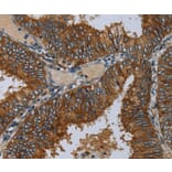 Immunohistochemistry - MIER2 Antibody from Signalway Antibody (36617) - Antibodies.com