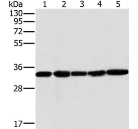 MTCH2 Antibody from Signalway Antibody (36621) - Antibodies.com