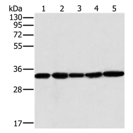 MTCH2 Antibody from Signalway Antibody (36621) - Antibodies.com