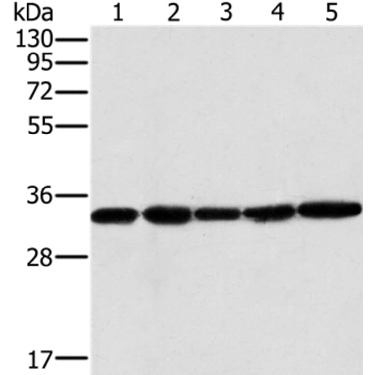 MTCH2 Antibody from Signalway Antibody (36621) - Antibodies.com