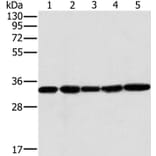 MTCH2 Antibody from Signalway Antibody (36621) - Antibodies.com