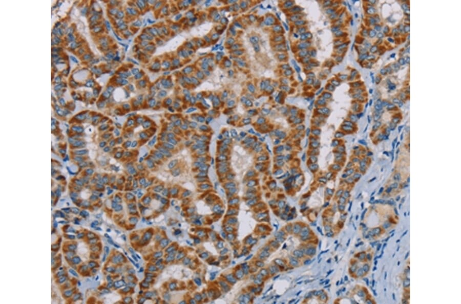 Immunohistochemistry - MTCH2 Antibody from Signalway Antibody (36621) - Antibodies.com