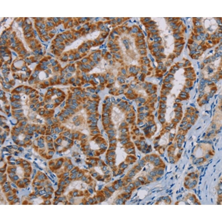 Immunohistochemistry - MTCH2 Antibody from Signalway Antibody (36621) - Antibodies.com