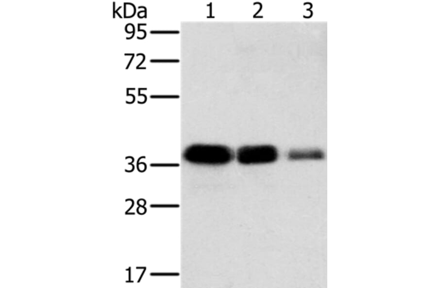 MTFR1 Antibody from Signalway Antibody (36624) - Antibodies.com