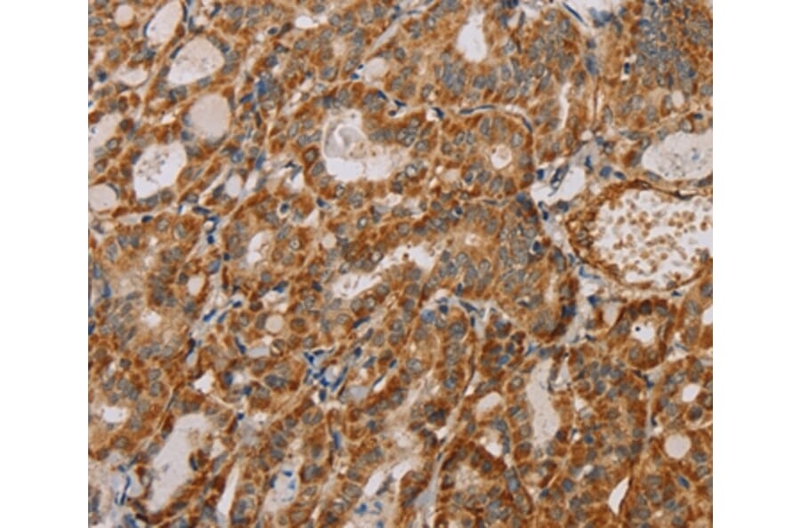 Immunohistochemistry - MTFR1 Antibody from Signalway Antibody (36624) - Antibodies.com