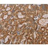Immunohistochemistry - MTFR1 Antibody from Signalway Antibody (36624) - Antibodies.com