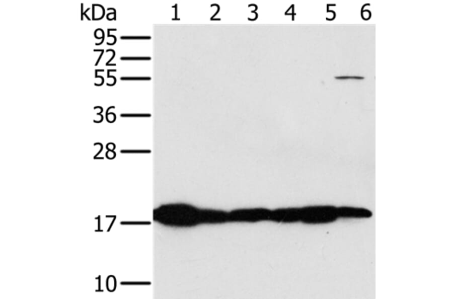 MTFP1 Antibody from Signalway Antibody (36625) - Antibodies.com