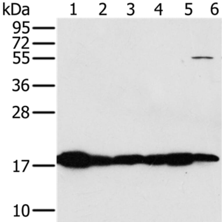 MTFP1 Antibody from Signalway Antibody (36625) - Antibodies.com
