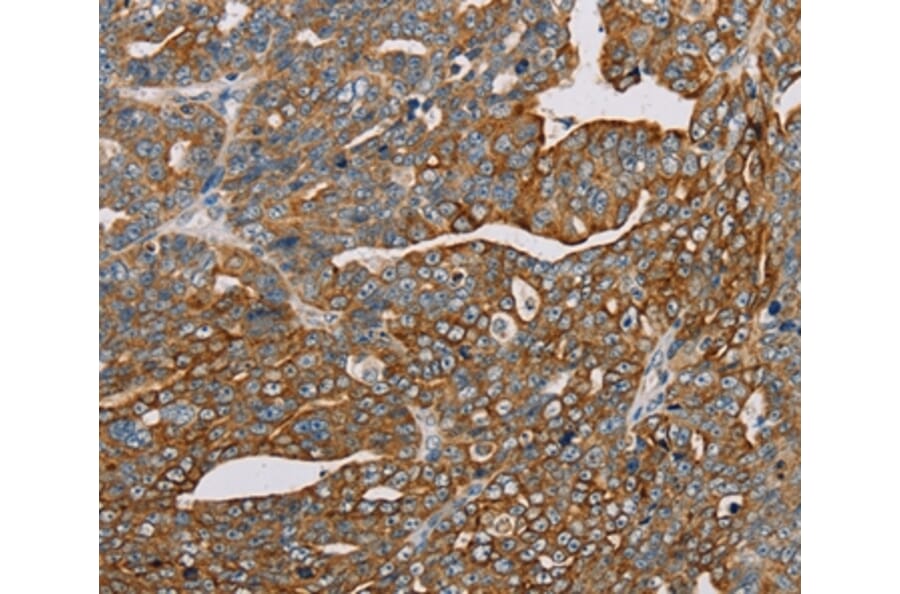 Immunohistochemistry - MTFP1 Antibody from Signalway Antibody (36625) - Antibodies.com