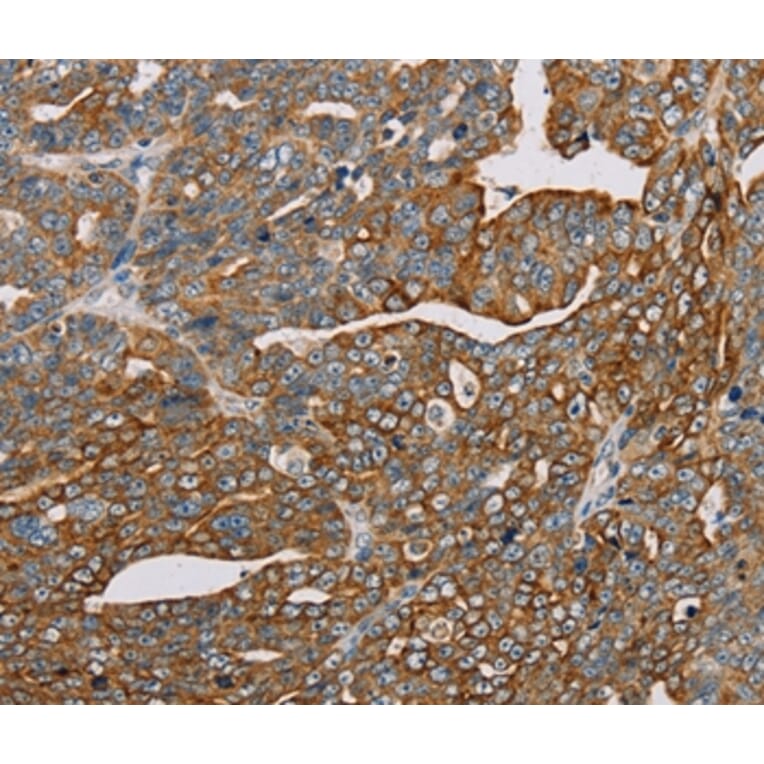 Immunohistochemistry - MTFP1 Antibody from Signalway Antibody (36625) - Antibodies.com